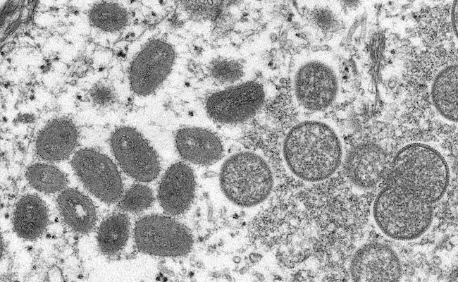 Imagen del virus, compartida por la OMS